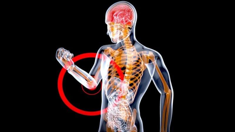 Neuropatisk Smärta: Orsaker, Symtom och Behandling