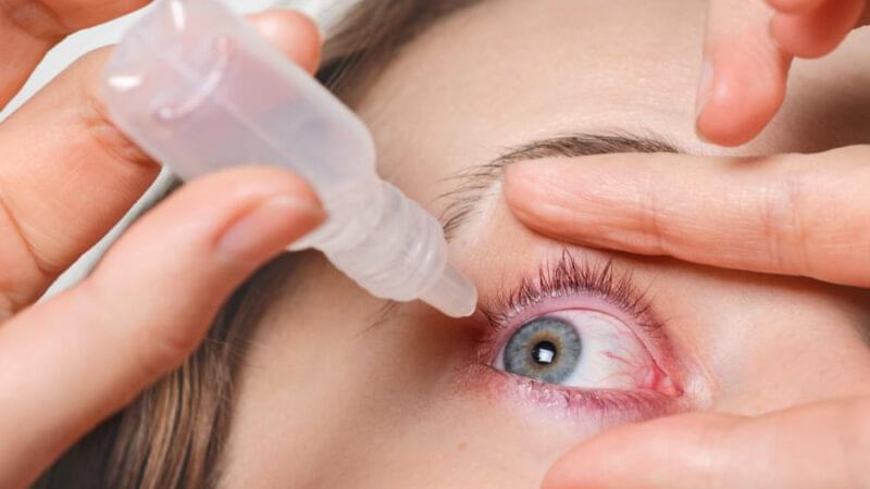 Ögoninflammation – enkla huskurer för att lindra besvär
