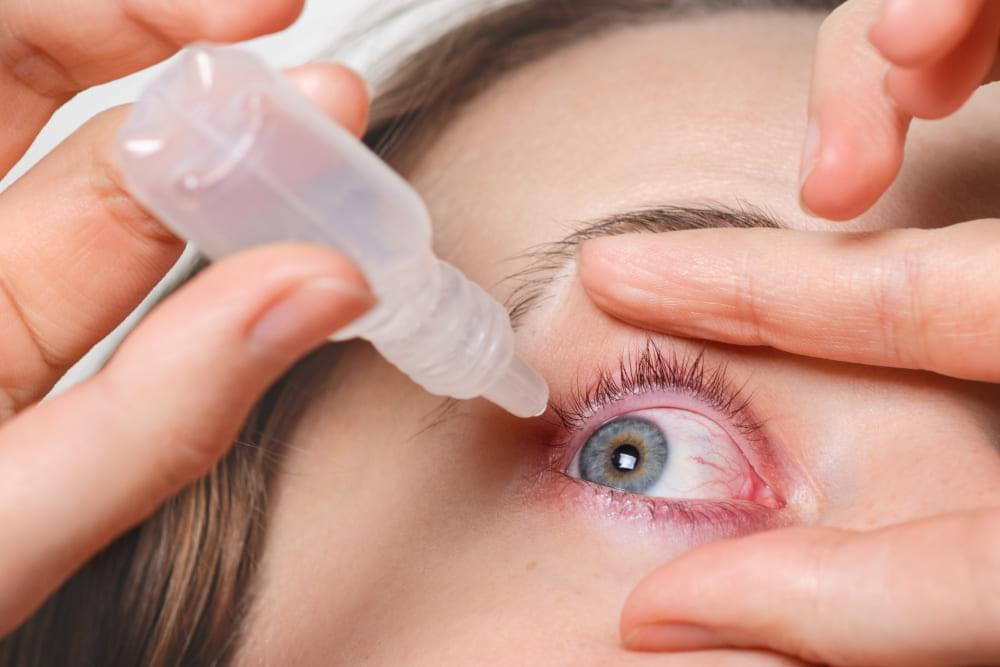 Ögoninflammation – enkla huskurer för att lindra besvär